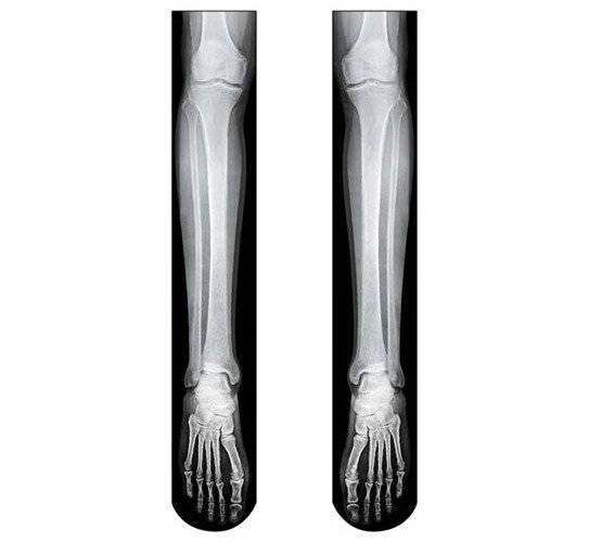 Podkolanówki SZKIELETOR z nadrukiem 3D